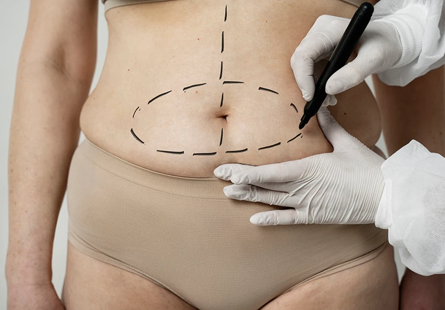 A cosmetic surgeon marketing a woman’s tummy