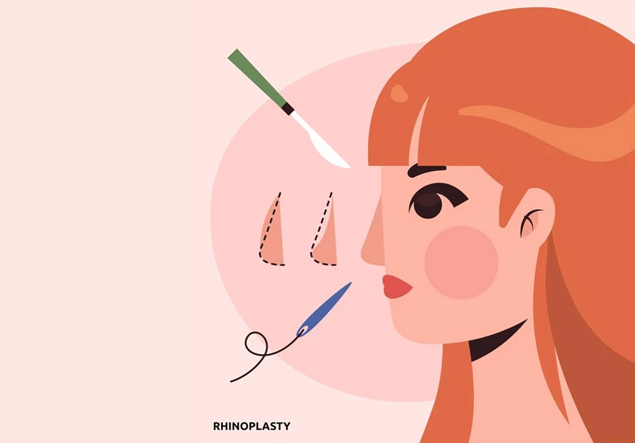 A hand-drawn flat design rhinoplasty illustration